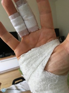 Fahrradunfall (Foto: Hanns Gröner)